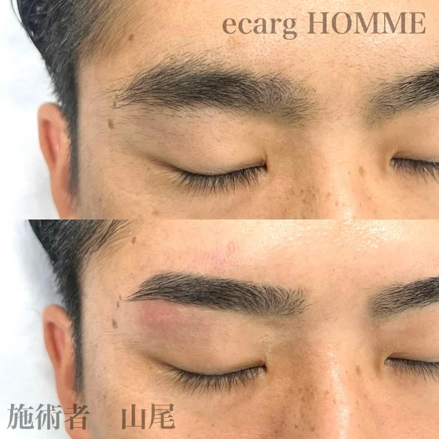 キリッとイケメン眉に！👀⚡️
夏は代謝が良くなり毛の生えるスピードが早くなりますので定期的なWAX脱毛がオススメです☺️
担当者 山尾

【メンズアイブロスタイリング】
3回目まで 税込5,500円
スタイリング+眉カラー 税込8,250円

24歳以下の学生さん 税込5,000円
スタイリング+眉カラー 税込7,500円

エサージュオム銀座店
📍104-0061 東京都中央区銀座６丁目８−１９ VORT銀座miyuki st 6F

Instagram @ecarg_homme

ホットペッパー・Webからもご予約頂けます。
お気軽にお問い合わせください♪
営業時間
平日、土10:00-20:00
日祝10:00-19:00
年中無休（年末年始を除く）

#眉カット#銀座#眉毛#wax脱毛#メンズエステ#脱毛サロン#眉力ラー#眉#眉メイク#アイブロウ#眉毛エクステ#メンズ眉サロン#大学生#就活#メンズアイブロウ#アイブロウサロン#ワックス脱毛#男性専門店#美容男子#イケメン#エサージュ#メンズコスメ#美眉スタイリング#エサージュオム#メンズ眉#メンズ眉毛サロン #韓国眉 #韓国風眉 #銀座眉毛サロン